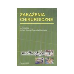 Zakażenia chirurgiczne