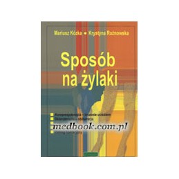 Sposób na żylaki