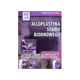 Alloplastyka stawu biodrowego