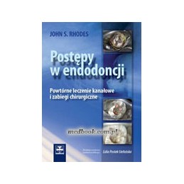 Postępy w endodoncji....