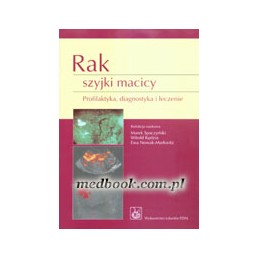 Rak szyjki macicy