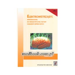 Elektrowstrząsy:...