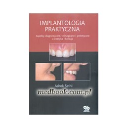 Implantologia praktyczna