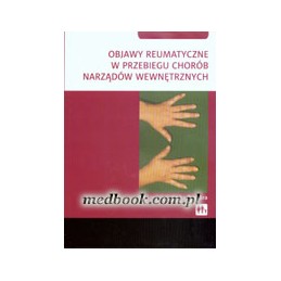 Objawy reumatyczne w...