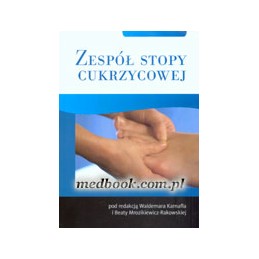 Zespół stopy cukrzycowej