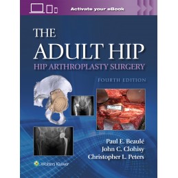 The Adult Hip: Hip Arthroplasty Surgery Print + digital version with Multimedia