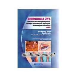 Chirurgia żył - tom 2