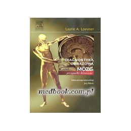 Diagnostyka obrazowa - mózg