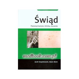 Świąd