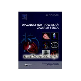 Diagnostyka powikłań zawału...
