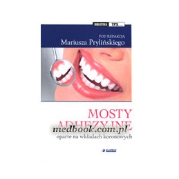 Mosty adhezyjne