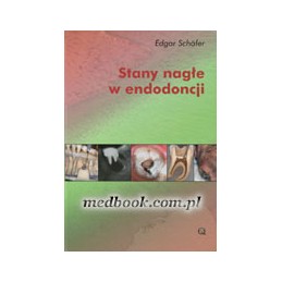 Stany nagłe w endodoncji