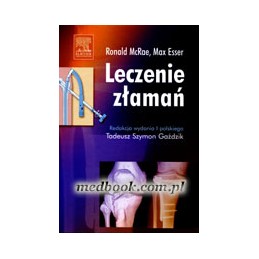Leczenie złamań
