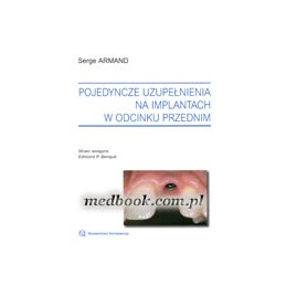 Pojedyncze uzupełnienia na...