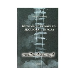 Deformacje kręgosłupa -...