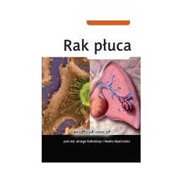 Rak płuca