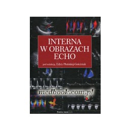 Interna w obrazach echo