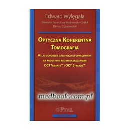 Optyczna koherentna tomografia