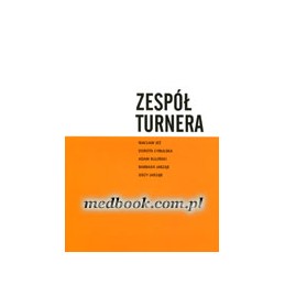 Zespół Turnera