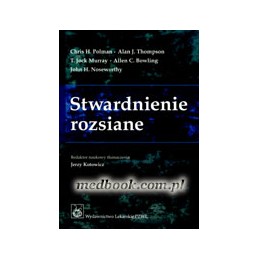 Stwardnienie rozsiane