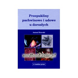 Przepukliny pachwinowe i...