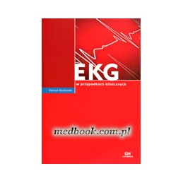 EKG w przypadkach klinicznych
