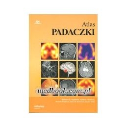 Atlas padaczki