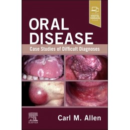 Oral Disease: Case Studies...