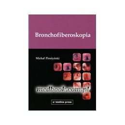 Bronchofiberoskopia