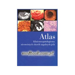 Atlas...