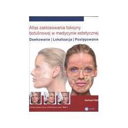 Atlas zastosowania toksyny...