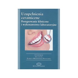 Uzupełnienia ceramiczne