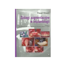 Zabiegi augmentacyjne w...