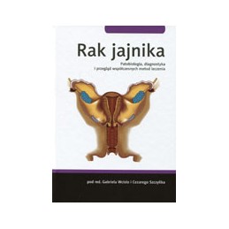 Rak jajnika