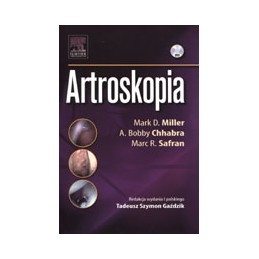 Artroskopia
