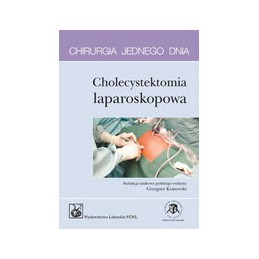 Cholecystektomia laparoskopowa