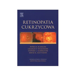 Retinopatia cukrzycowa