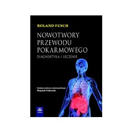 Nowotwory przewodu pokarmowego