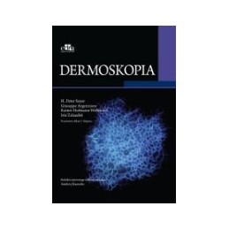 Dermoskopia