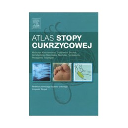Atlas stopy cukrzycowej
