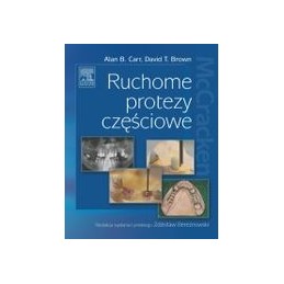 Ruchome protezy częściowe...