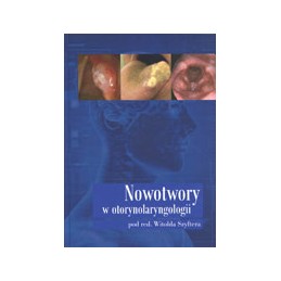 Nowotwory w...