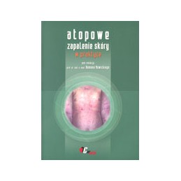 Atopowe zapalenie skóry w...