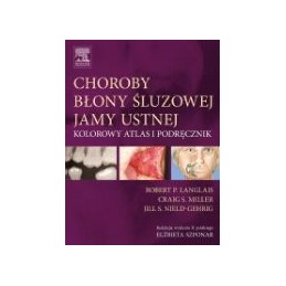Choroby błony śluzowej jamy...