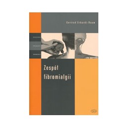 Zespół fibromialgii