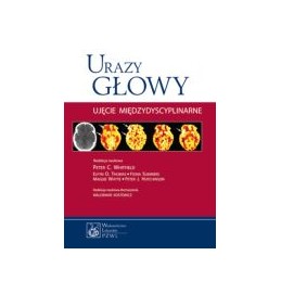 Urazy głowy