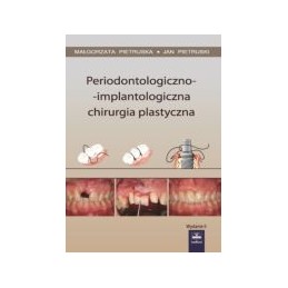 Periodontologiczno-implanto...
