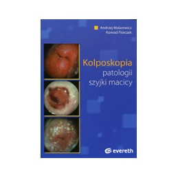 Kolposkopia patologii...