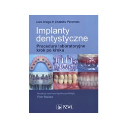 Implanty dentystyczne