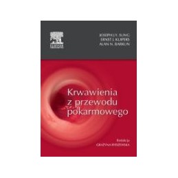 Krwawienia z przewodu...